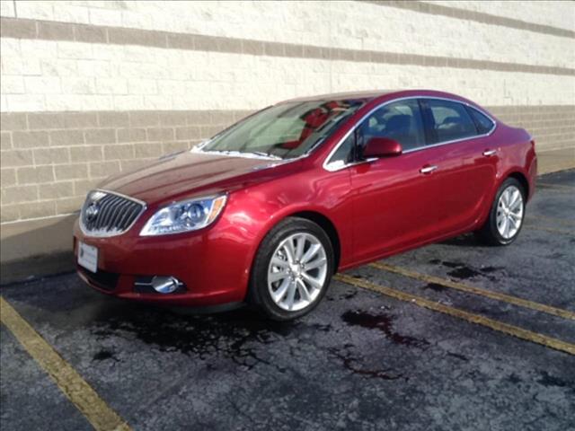 Buick Verano 2014 photo 2